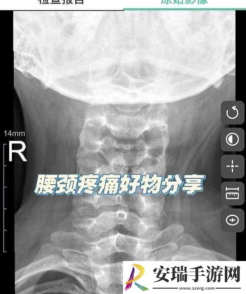 颈腰挺过那层薄膜好疼