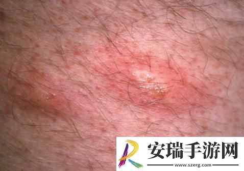 “两个蛋蛋”之谜