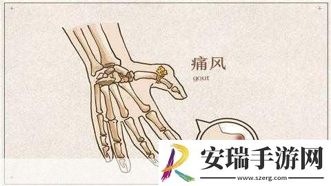 宝宝怎么才三根手指就痛1.宝宝三根手指疼痛的原因与解决办法