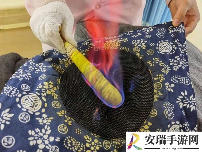 让头顶冒火的针灸形容的是以下哪种传统治疗手段