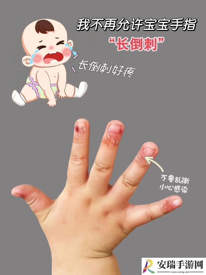 宝宝怎么才三根手指就痛
