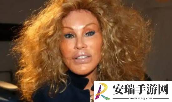 整容成“猫女”的瑞士名媛因心脏衰竭去世