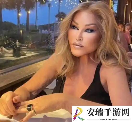 整容成“猫女”的瑞士名媛因心脏衰竭去世